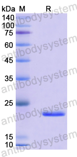 Recombinant Human FRS2 Protein, N-His-SUMO
