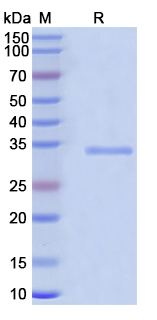 Recombinant Human CYGB Protein, N-His-SUMO