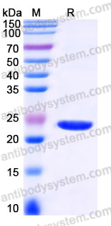 Recombinant Human CYGB Protein, C-His