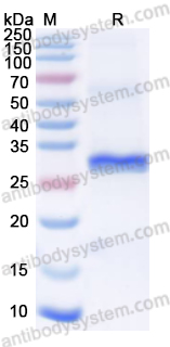 Recombinant Human NEU4 Protein, N-His