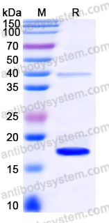 Recombinant Human IL38/IL1F10 Protein, Tag free