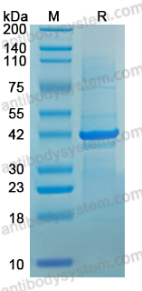 Recombinant Human HDAC2 Protein, C-His