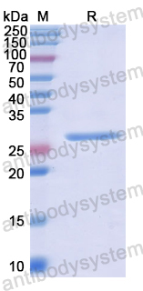 Recombinant Human CASP10 Protein, N-His