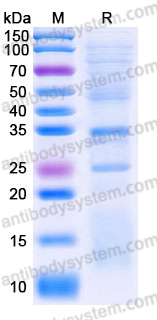 Recombinant Human CASP10 Protein, C-His