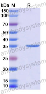 Recombinant Human KLK6 Protein, N-His-SUMO