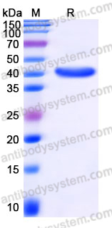 Recombinant Human GCDH Protein, N-His