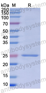 Recombinant Human TNPO1 Protein, N-His