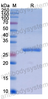 Recombinant Human OTUB2 Protein, N-His
