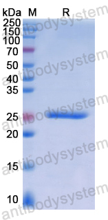 Recombinant Human LGALS12 Protein, N-His