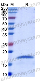 Recombinant Human CNRIP1 Protein, N-His