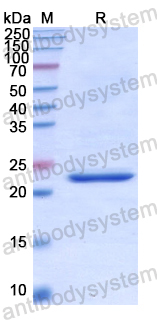 Recombinant Human FAM20A Protein, N-His