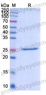 Recombinant Human KREMEN1 Protein, N-His