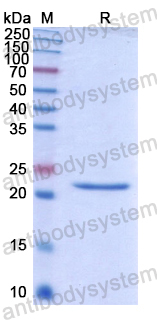 Recombinant Human MOGAT1 Protein, N-His
