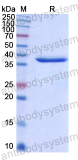 Recombinant Human NOX5 Protein, N-His