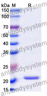 Recombinant Human NOX5 Protein, N-His