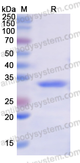Recombinant Human NR1H4/FXR Protein, N-His