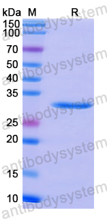 Recombinant Human CNN2 Protein, N-His