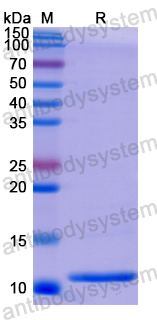 Recombinant Human DDO Protein, N-His