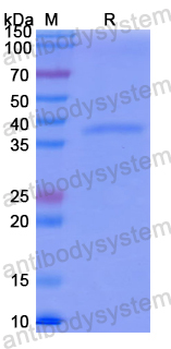 Recombinant Human OSMR Protein, N-His