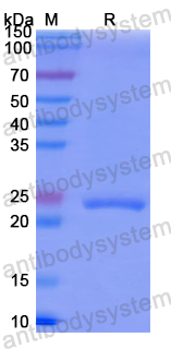 Recombinant Human CHP1 Protein, N-His