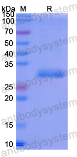 Recombinant Human MAP3K5 Protein, N-His