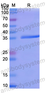 Recombinant Human MGLL Protein, N-His