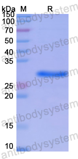 Recombinant Human SMAD5 Protein, N-His