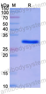 Recombinant Human SEPTIN5 Protein, N-His