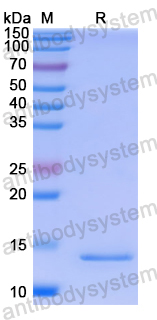 Recombinant Human SLC30A3 Protein, N-His