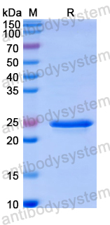 Recombinant Human TIMP4 Protein, N-His