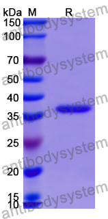 Recombinant Human CCL19/MIP-3-beta Protein, N-GST & C-His
