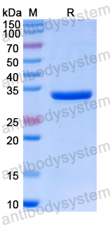 Recombinant Human ABCA3 Protein, N-His