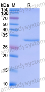 Recombinant Human APBA2 Protein, N-His
