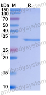 Recombinant Human OLFM1 Protein, N-His
