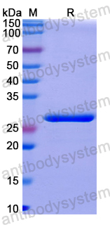 Recombinant Human TSG101 Protein, N-His