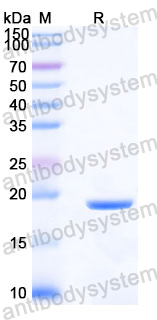 Recombinant Human TSG101 Protein, N-His