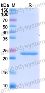 Recombinant Human CITED1 Protein, N-His
