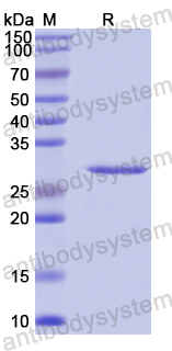 Recombinant Human NUP85 Protein, N-His