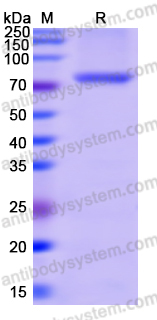 Recombinant Human MDA5/IFIH1 Protein, N-His
