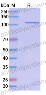 Recombinant Human MDA5/IFIH1 Protein, N-GST & C-His