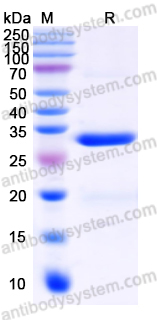 Recombinant Human FOXP3 Protein, N-His-SUMO