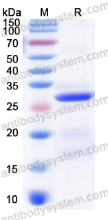 Recombinant Human FGF23 Protein, N-His