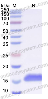 Recombinant Human FGF23 Protein, N-His