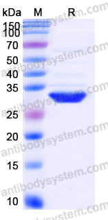 Recombinant Human TOLLIP Protein, C-His
