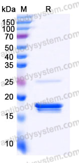 Recombinant Human ZBP1 Protein, C-His