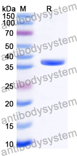 Recombinant Human ATG5 Protein, N-Avi-His