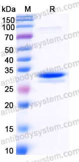 Recombinant Human ATG5 Protein, Tag free