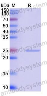 Recombinant Human MMP28 Protein, N-His