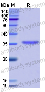 Recombinant Human CXCL16/SR-PSOX Protein, N-GST