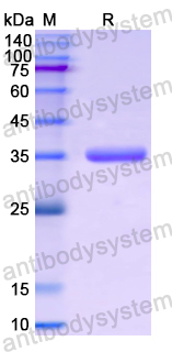 Recombinant Human TP63 Protein, N-His